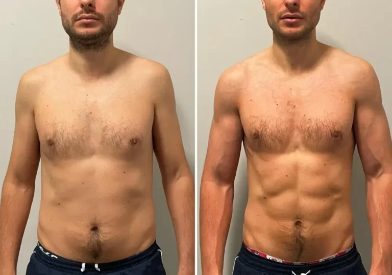 male-body-transformation-london-4
